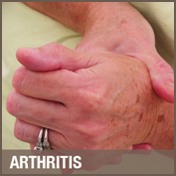 Arthritis, Chiropractor Northern Ireland